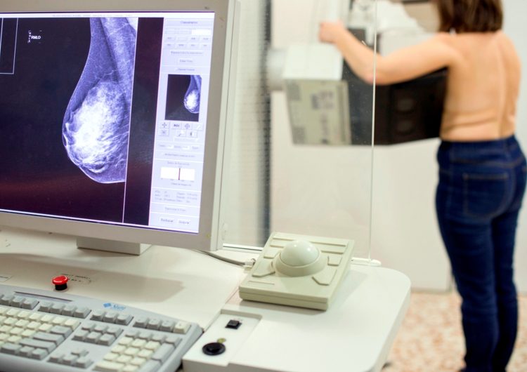 El programa de detecció precoç de càncer de mama a Catalunya detecta més de 1.200 tumors, molts en fase inicial